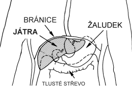 Ztučnělá játra