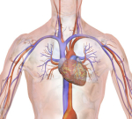 Ateromatóza aorty